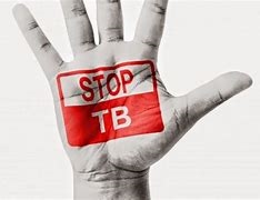 TB Prevention