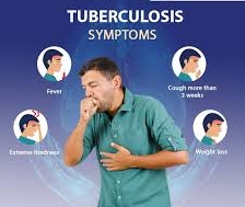 TB Signs & Symptoms